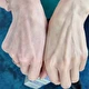 Veido kremas „Prototype Spider Veins“ odai su išsiplėtusiais kapiliarais